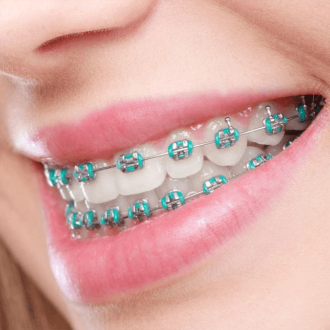 Imagem Ilustração Aparelho