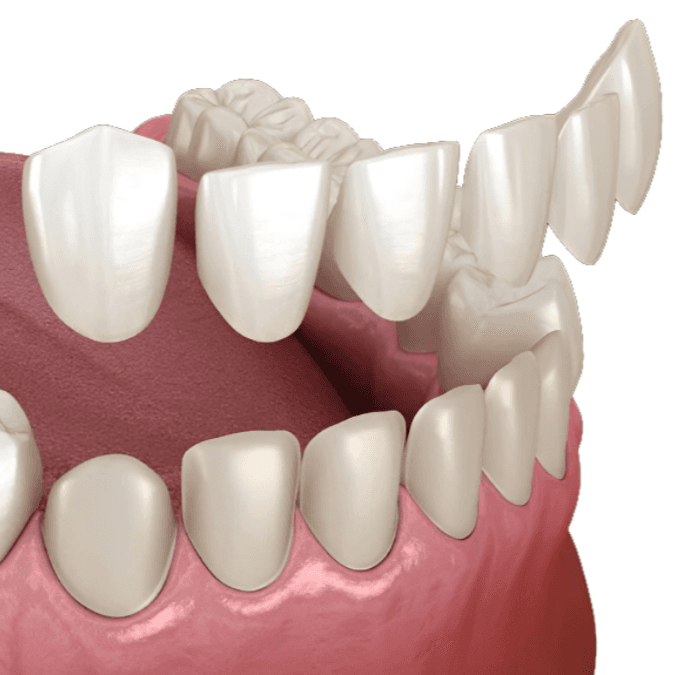 Imagem Ilustração Lentes