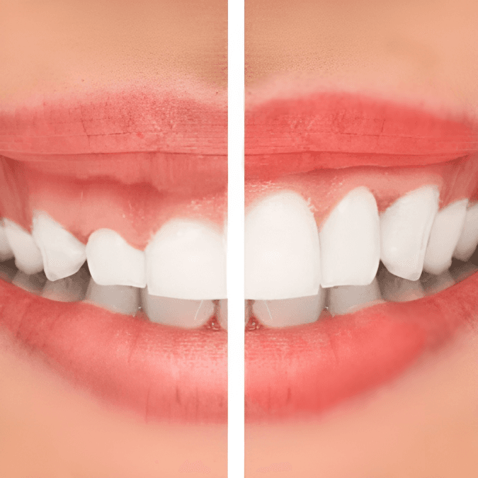 Imagem Ilustração Plastica