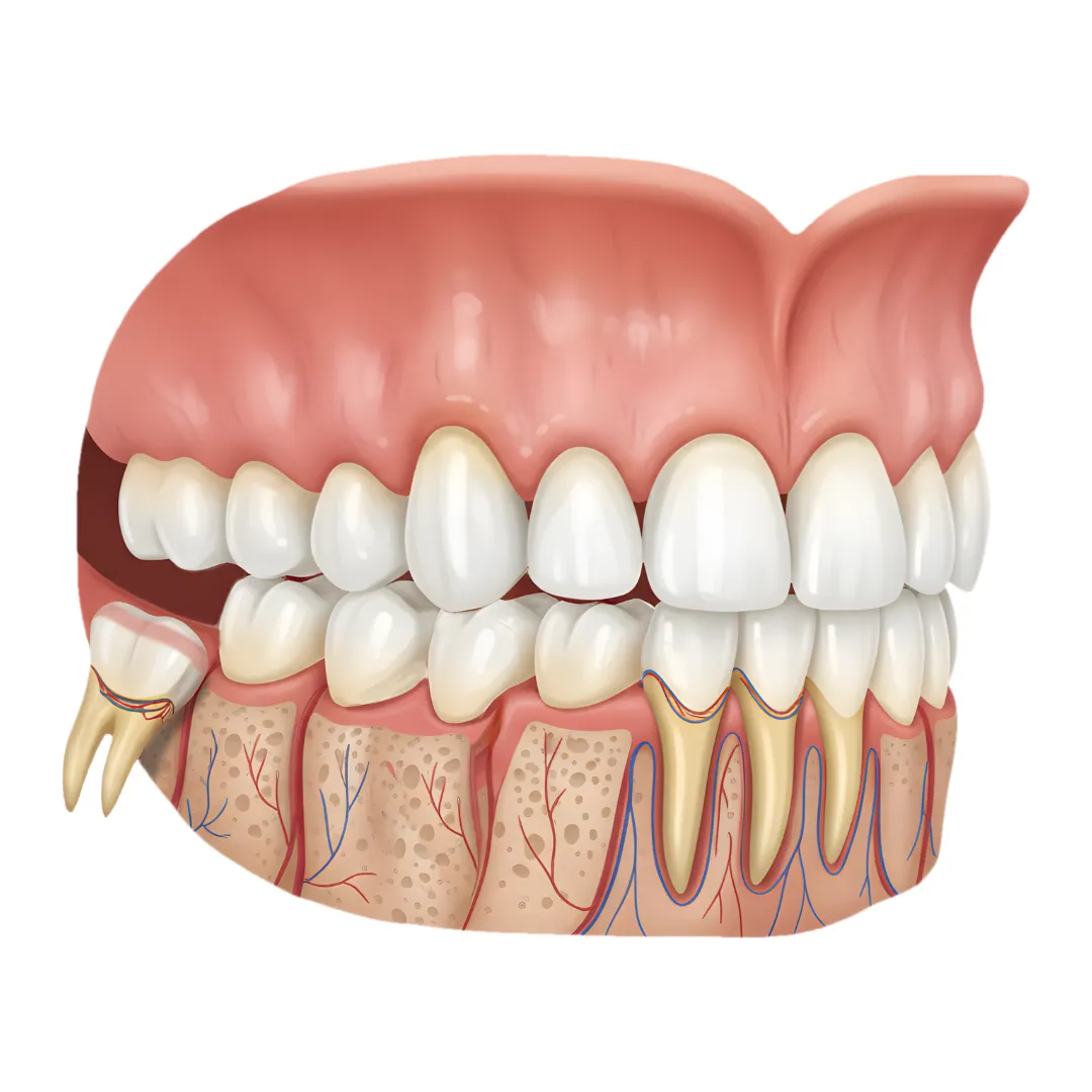 Imagem Ilustração Siso